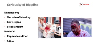 Seriousity of Bleeding
Depends on;
• The rate of bleeding
• Body region
• Blood amount
Person’s:
• Physical condition
• Age…
 