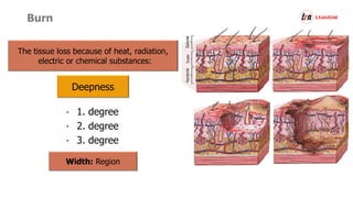 Burn
The tissue loss because of heat, radiation,
electric or chemical substances:
Deepness
• 1. degree
• 2. degree
• 3. degree
Width: Region
 