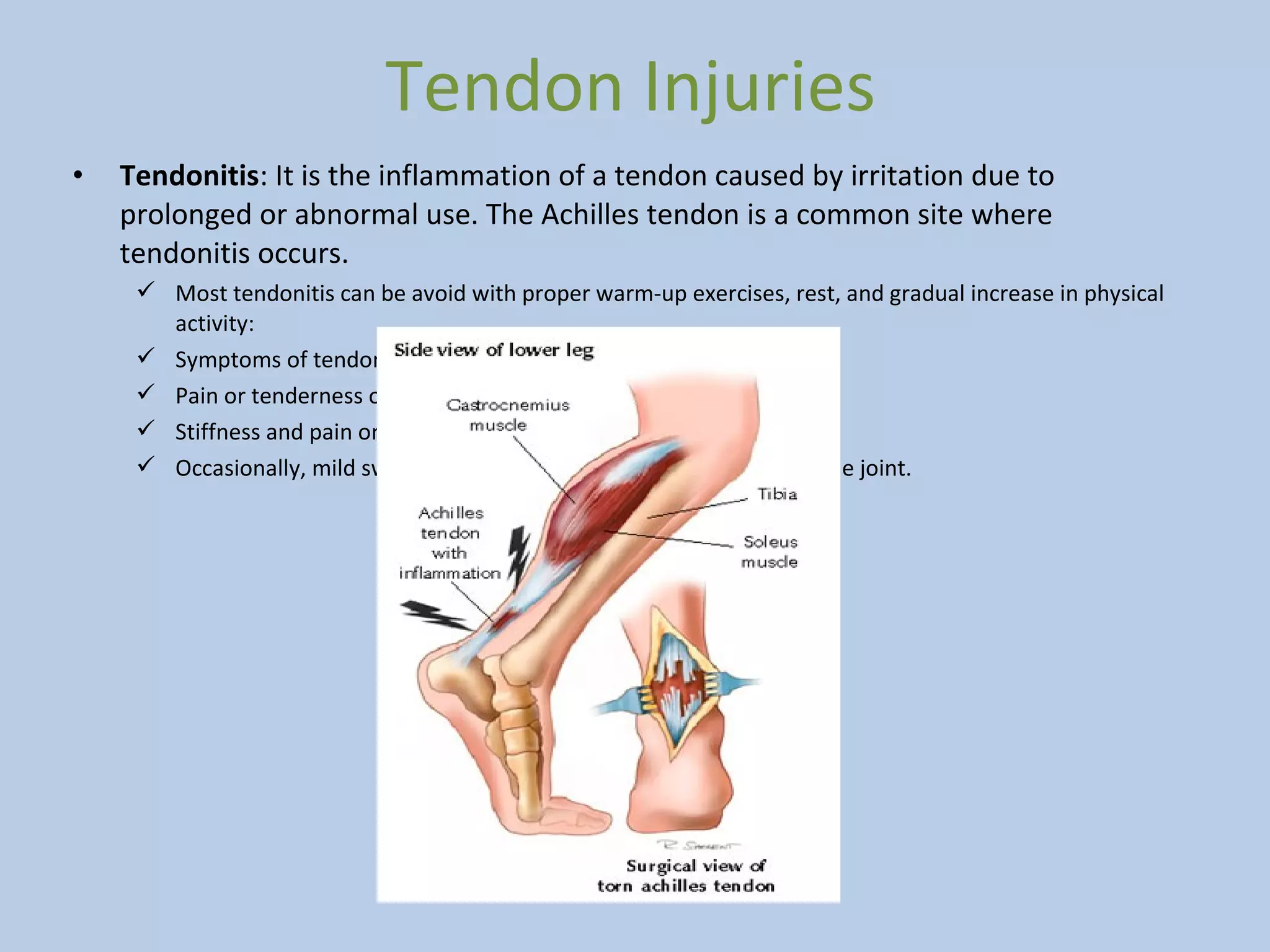 Tendon Injuries Animation First Aid and Sport Injuries | PPT