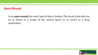 Open Wound
In an open wound, the outer layer of skin is broken. The break in the skin can
be as minor as a scrape of the surface layers or as severe as a deep
penetration.
 
