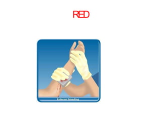 RED
 