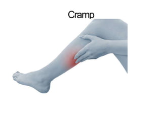 Cramp
 