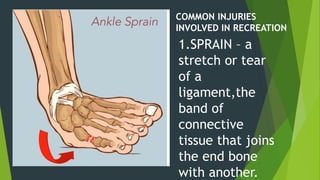 COMMON INJURIES
INVOLVED IN RECREATION
1.SPRAIN – a
stretch or tear
of a
ligament,the
band of
connective
tissue that joins
the end bone
with another.
 