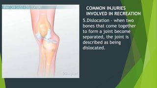 COMMON INJURIES
INVOLVED IN RECREATION
5.Dislocation – when two
bones that come together
to form a joint become
separated, the joint is
described as being
dislocated.
 