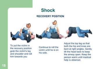 Stable Side Position First Aid Training HSE Presentation .ppt
