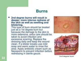 First Aid Training HSE Presentation .ppt