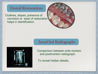 Dental Restorations
Outlines, slopes, presence of
corrosion or wear of restoration
helps in identification.
IntraOral Radiographs
Comparison between ante mortem
and postmortem radiograph.
To reveal hidden details.
 