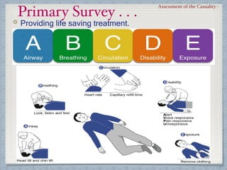 Primary Survey . . .
Assessment of the Casuality :
Providing life saving treatment.
 