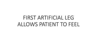 FIRST ARTIFICIAL LEG
ALLOWS PATIENT TO FEEL
 