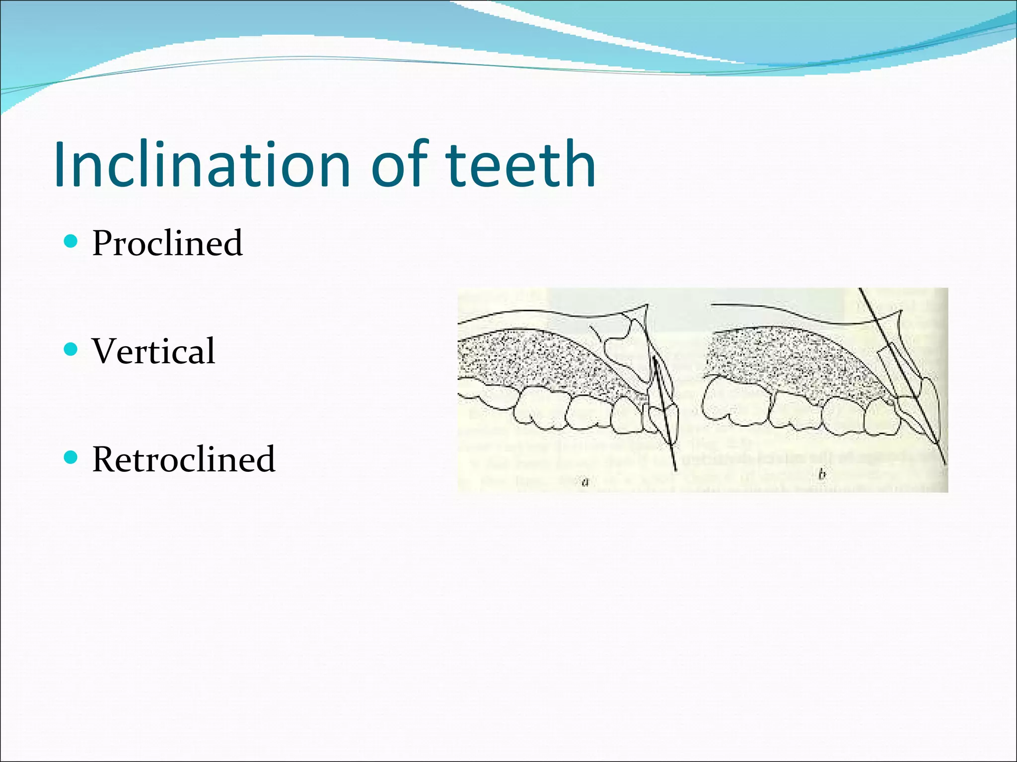 Inclination of teeth Proclined Vertical Retroclined 
