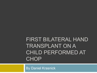 FIRST BILATERAL HAND
TRANSPLANT ON A
CHILD PERFORMED AT
CHOP
By Daniel Krasnick
 