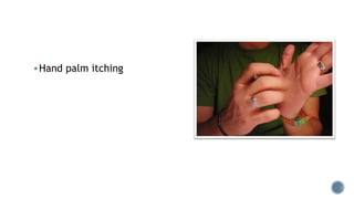 Hand palm itching
 