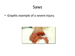 Saws
• Graphic example of a severe injury.
 