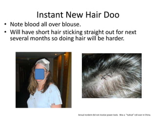 Instant New Hair Doo
• Note blood all over blouse.
• Will have short hair sticking straight out for next
  several months so doing hair will be harder.




                             Actual incident did not involve power tools. Was a “tuktuk” roll-over in China.
 
