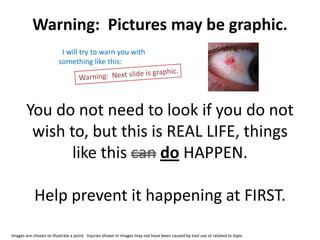 Warning: Pictures may be graphic.
                          I will try to warn you with
                         something like this:




        You do not need to look if you do not
         wish to, but this is REAL LIFE, things
               like this can do HAPPEN.

            Help prevent it happening at FIRST.

Images are chosen to illustrate a point. Injuries shown in images may not have been caused by tool use or related to topic.
 