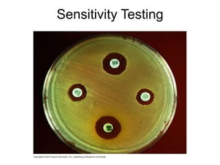 Sensitivity Testing
 