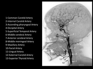 1-Common Carotid Artery
2-Internal Carotid Artery
3-Ascending pharyngeal Artery
4-Occipital Artery
5-Superficial Temporal Artery
6-Middle cerebral Artery
7-Anterior cerebral Artery
8-Middle meningeal Artery
9-Maxillary Artery
10-Facial Artery
11-Lingual Artery
12-External Carotid Artery
13-Superior Thyroid Artery
 