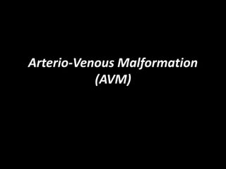 Arterio-Venous Malformation
(AVM)
 