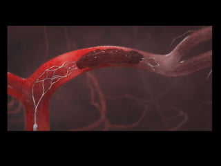 Cerebral Vascular Anatomy and Technique