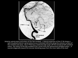 Anterior spinal artery and artery of the falx cerebelli , a lateral projection of the LT VA shows a
well-visualized anterior spinal artery (a.sp.a.) directed inferiorly along the anterior surface of
the medulla and spine , the LT PICA has a relatively high origin off the intradural left vertebral
artery , the artery of the falx cerebelli (f.cb.) arises from the extracranial vertebral artery , it
courses diagonally toward the torcular deviating away from the inner table of the skull
 