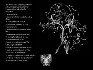 -3D frontal view following vertebral
artery injection , shows normal
intracranial vertebral basilar
circulation
1 vertebral artery
2 posterior inferior cerebellar artery
(PICA)
2v vermian branch of PICA
2h hemispheric branch of PICA
3 basilar artery
4 anterior inferior cerebellar artery
(AICA)
5 superior cerebellar artery (SCA)
5h hemispheric branch of SCA
5v vermian branch of SCA
6 posterior cerebral artery (PCA)
6.2 P2 segment of PCA
8 posterior temporal branch of PCA
9 parieto-occipital branch of PCA
10 calcarine branch of PCA
12 posterior thalamoperforating arteries
13L lateral posterior choroidal artery
16 pontine perforating artery
 