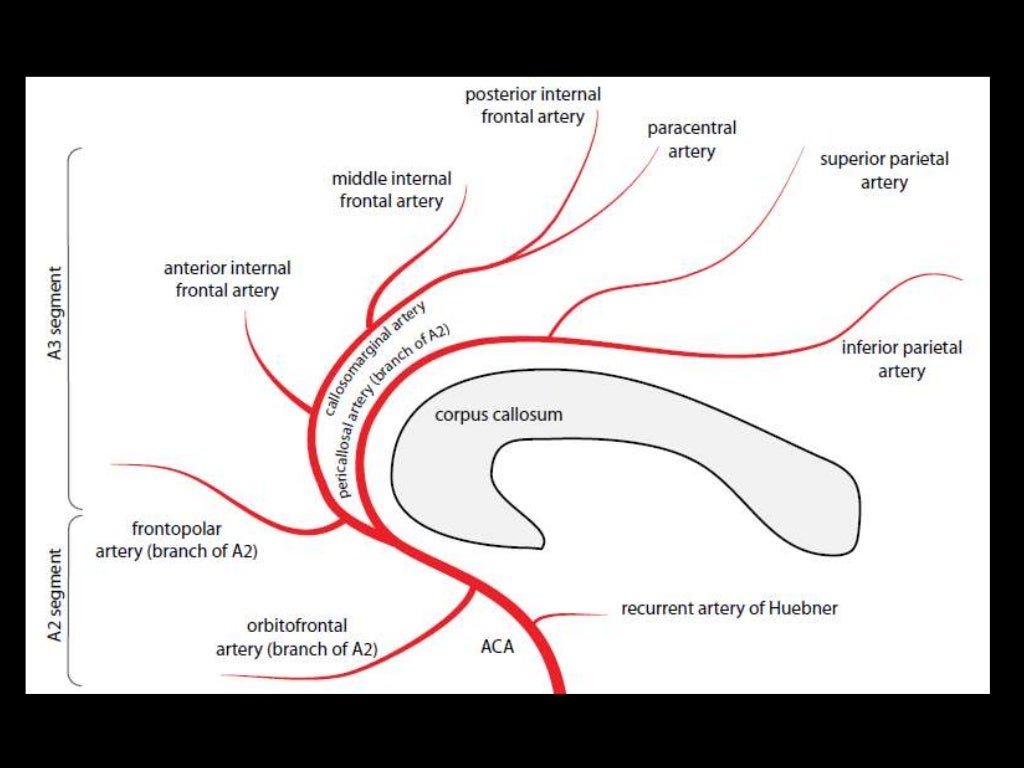 *Arteries to the Parietal & Occipital lobes:
-These run posterior to the sylvian fissure , from
superior to inferior :
1-A...