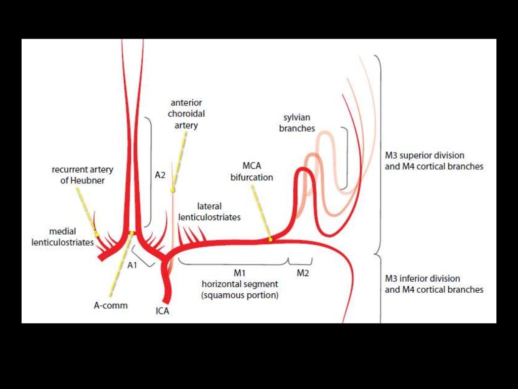 -Frontal 2D view following
right vertebral artery
injection , there is a
normal appearance of the
cervical vertebral arter...