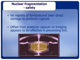Srugery Magic Femtosecond Laser Cataract Surgery – Magic or Myth? | PPT