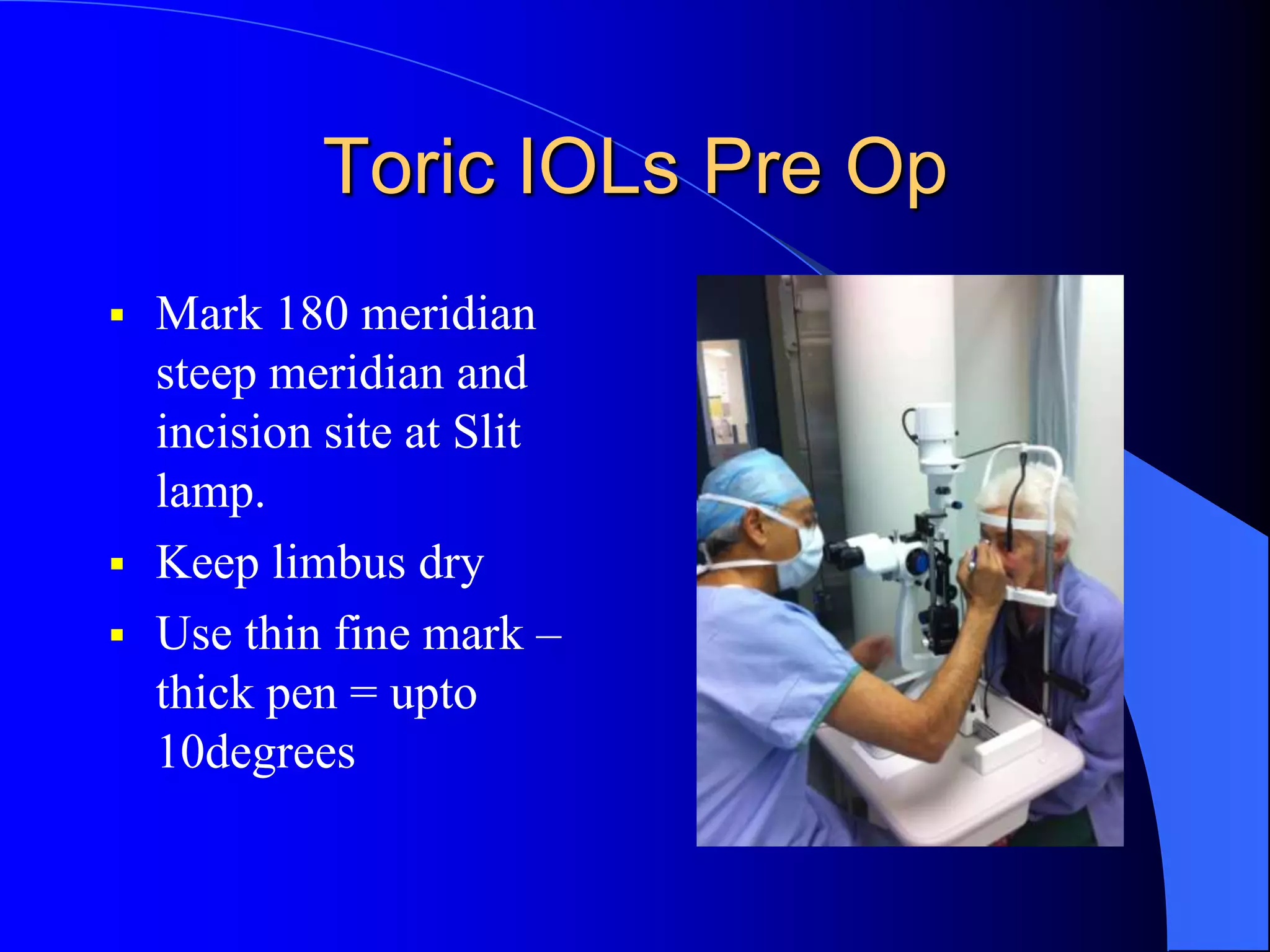 Toric IOLs Pre Op
 Mark 180 meridian
steep meridian and
incision site at Slit
lamp.
 Keep limbus dry
 Use thin fine mark –
thick pen = upto
10degrees
 