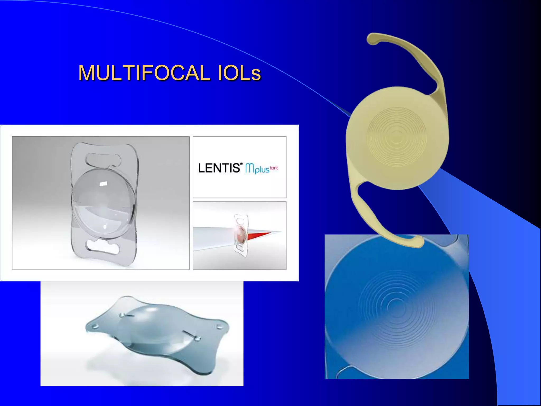 MULTIFOCAL IOLs
 