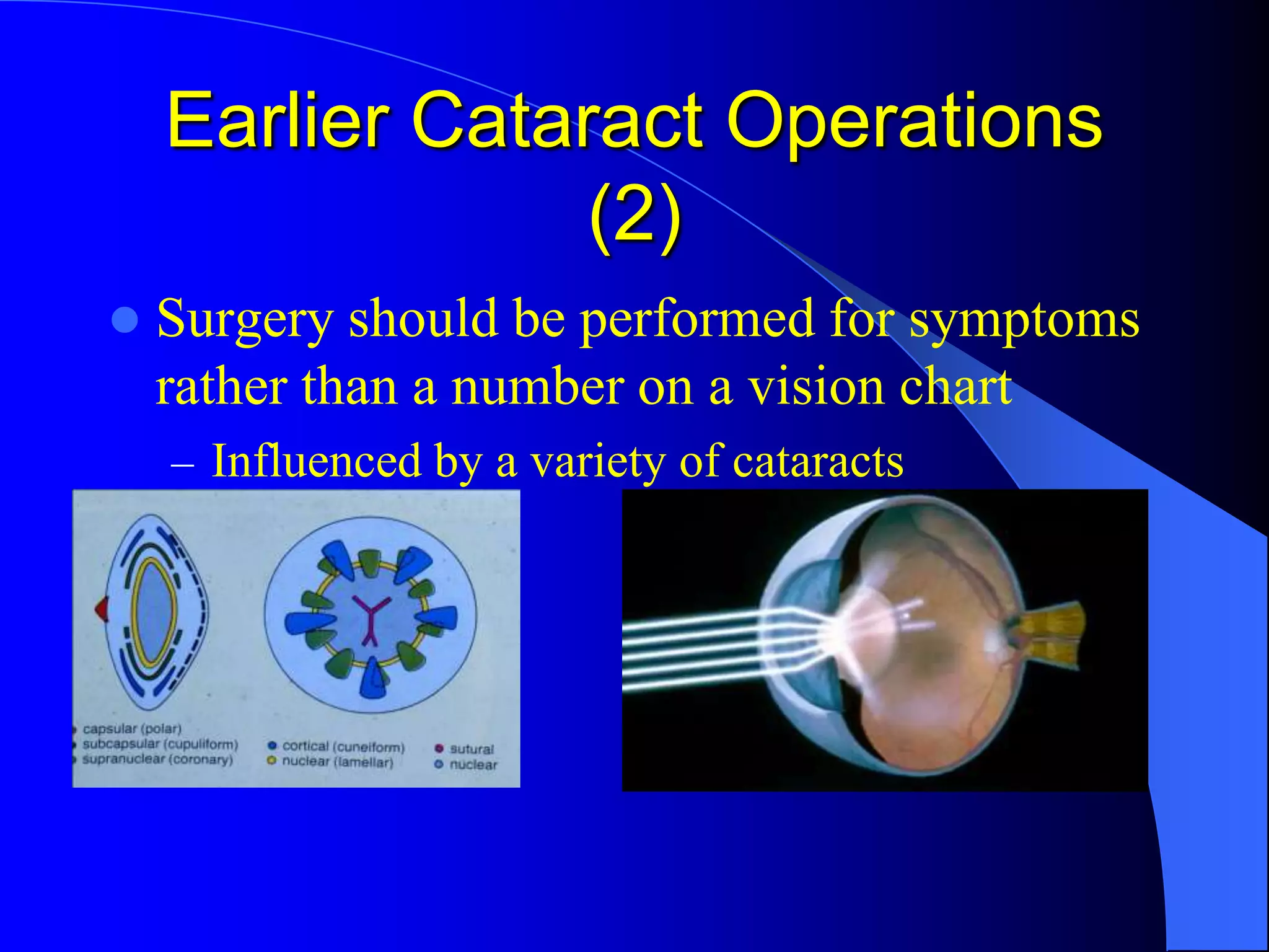 Earlier Cataract Operations
(2)
 Surgery should be performed for symptoms
rather than a number on a vision chart
– Influenced by a variety of cataracts
 