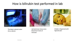 How is bilirubin test performed in lab
A baby is diagnosed with
high bilirubin
Lab technician draw some
blood from heels of
neonatal
The baby is placed under
the uv device
2/20/2024 8
 