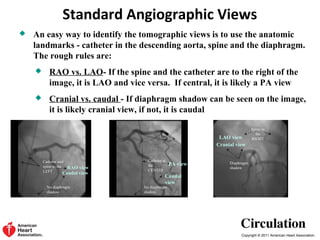 Anatomic Heart Rao First step of coronary angiography | PPT