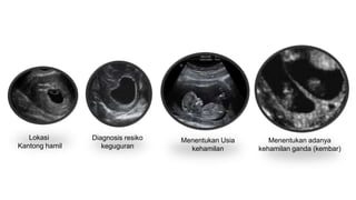 First trimester screening for fetal abnormalities | PPT