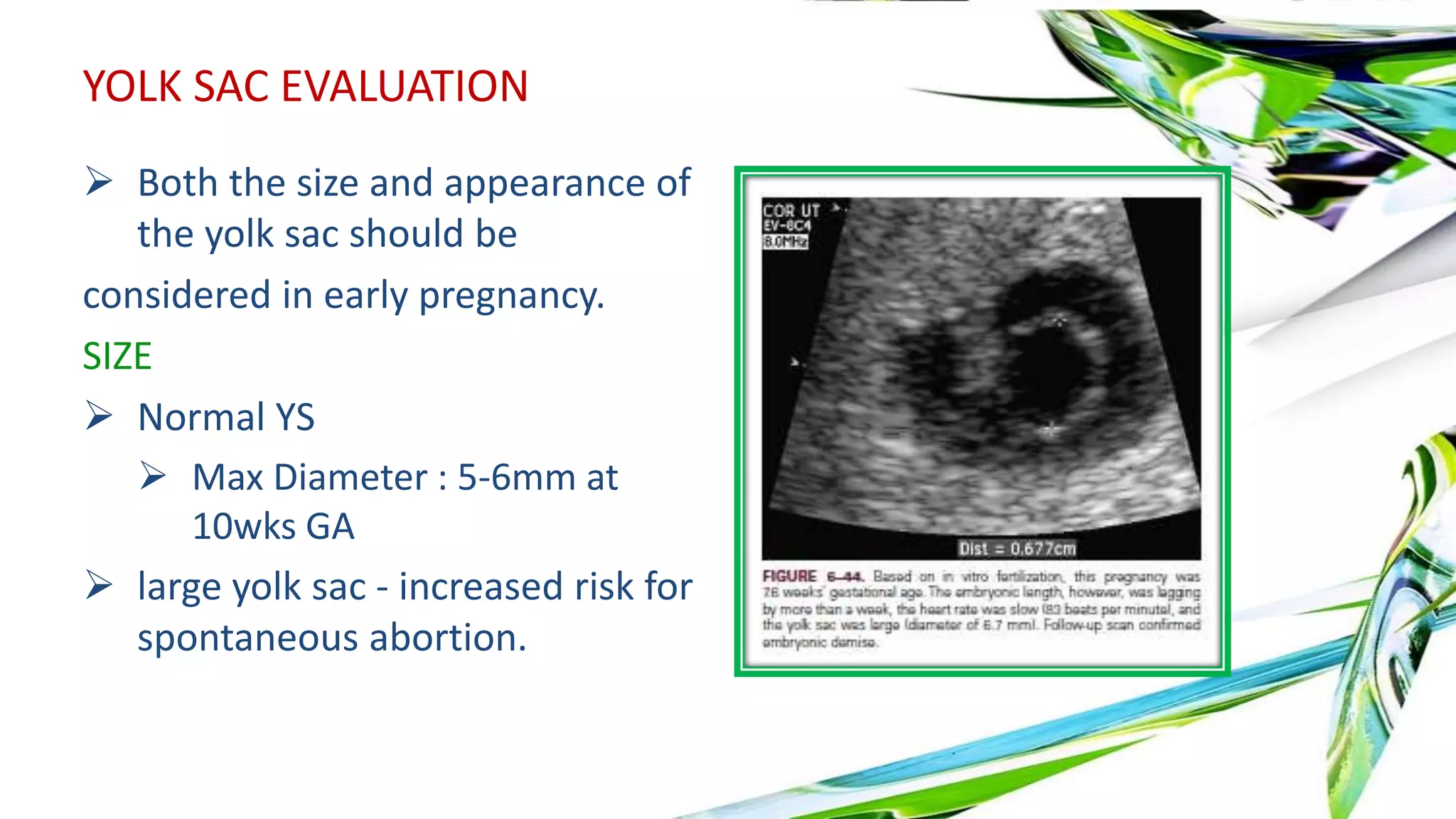 First trimester ultrasound | PPTX