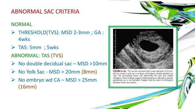First trimester ultrasound | PPTX