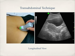 Transabdominally First Trimester US and use in the emergency department | PDF