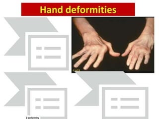 Loading…
History of presentation
• Local Symptoms:
— Swelling.
— Dragging sensation.
— pain.
• Ask about predisposing factors:
Chronic cough .
Chronic constipation .
Straining with micturition.
 