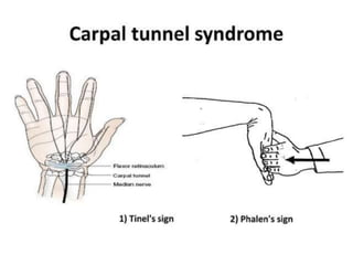 emergency presentation
• Irreducible.
• Incarcerated:
The content are literally
imprisoned in the hernial
sac (usually by
adhesions) but are
healthy.
 