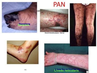 Loading…
Standing position
• Exposure (nipple to knee)
• Ask patient to stand up.
• Inspection:
— Site
• Right or left
• Above or below groin
cease
• Reaches the scrotum
or not
 