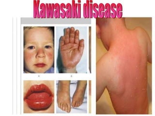 • Size.
• Shape.
• Skin over it.
• Pulsatile or not.
• Is there any discharges.
• If it is apparent with cough?
• Can Patient reduce it or not?
• Any other swellings?
 