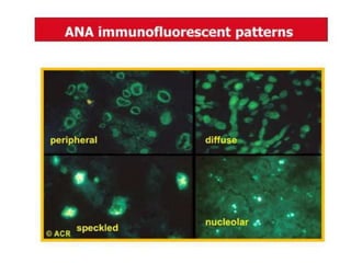 For any cause can elevate the intra-
abdominal pressure ( enlarged
prostate, Ascites, Pregnancy, intra-
abdominal masses, Intestinal
Obstruction).
• Cardiovascular and respiratory
assessment.
 