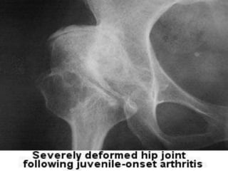 Loading…
History Taking
● A history is the story of the patients illness
● It is the first step in determining the etiology of
a patient’s problem
● Let the patient describe his or her problem
● Be a medical detective to establish the diagnosis
 