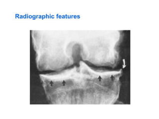 History Taking
●  80% of diagnosis may be made from history
alone
● Examination and investigations would either
confirm or refute the history based diagnosis
 