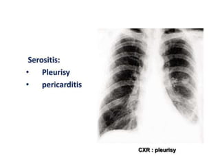 ● The patient initiates this by describing a
particular symptom which you would use for
additional questioning that will help identify
the cause of the problem
 