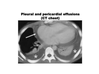 Understanding the Pathophysiology of
disease (Medical Knowledge) as well as
Increased Exposure to Patients and
disease will improve the skill of taking a
good history
 