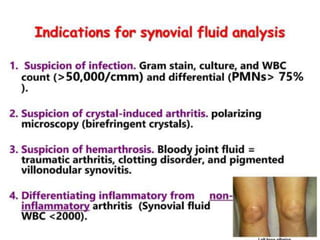 3. HAEMOPTYSIS
CAUSES :
Common:
● Bronchial Carcinoma
● Pulmonary Infarction
● TB
● Bronchiectasis
● Lung Abscess
● Acute/chronic
bronchitis
Other:
● Mitral stenosis
● Aspergilloma
● Connective tissue
disease
● Goodpasteur’s disease
● Foreign body
● Anticoagulation
● Chest trauma
 