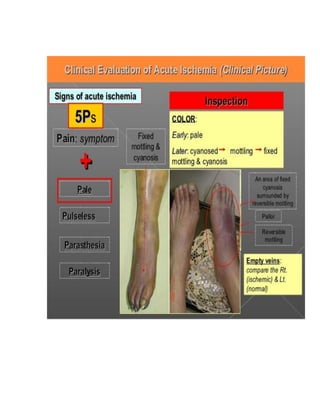 3. Severity or Grade:
How far the patient can walk on the flat without stopping
How many steps can be climbed without stopping
Do you feel breathless when washing or dressing
Do you feel breathless at rest
4. Variability:
Episodic ( intermittent) or persistent
Worse at night and early morning (morning dippers in asthma)
Lying flat (orthopnea) in heart failure and severe airway
obstruction
5. AGGREVATING  RELIEVING FACTORS:
Exercise, cold exposure, Excitement, Drugs
 