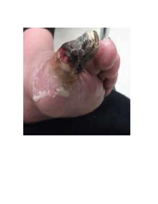 How To Assess A Patient With Chest
Pain
Enquire about:
● Site
● Mode of onset
● Character
● Radiation
● Intensity
● Precipitating , Aggravating and relieving factors.
● Relationship to breathing, coughing or movement
 