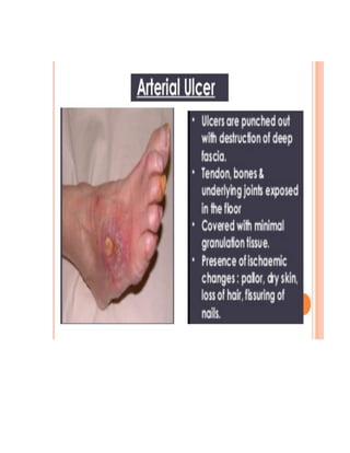 Co-existing Symptoms
● Fever
● Hoarseness of voice
● Ankle swelling
● Poor appetite and weight loss
● Snoring and day time sleepiness
 